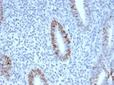 Immunohistochemistry-Paraffin: Cyclin E1 Antibody (CCNE1/4935R) - Azide and BSA Free [NBP3-08810] - Formalin-fixed, paraffin-embedded human endometrium stained with Cyclin E1 Recombinant Rabbit Monoclonal Antibody (CCNE1/4935R).