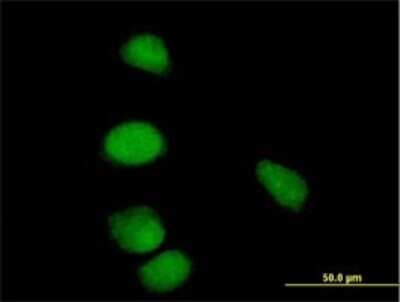 Immunocytochemistry/Immunofluorescence: Cyclin E1 Antibody [H00000898-B03P] - Analysis of purified antibody to CCNE1 on HeLa cell. Antibody concentration 10 ug/ml
