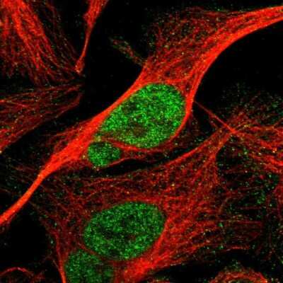 Immunocytochemistry/Immunofluorescence: Cyclin E1 Antibody [NBP1-88153] - Immunofluorescent staining of human cell line U-2 OS shows localization to nucleoplasm.