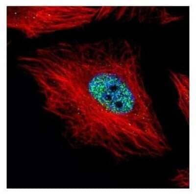 Immunocytochemistry/Immunofluorescence: Cyclin E1 Antibody [NBP2-16055] - Confocal immunofluorescence analysis of paraformaldehyde-fixed HeLa, using Cyclin E1 antibody (Green) at 1:500 dilution. Alpha-tubulin filaments are labeled with Alpha-tubulin antibody (Red) at 1:2000.