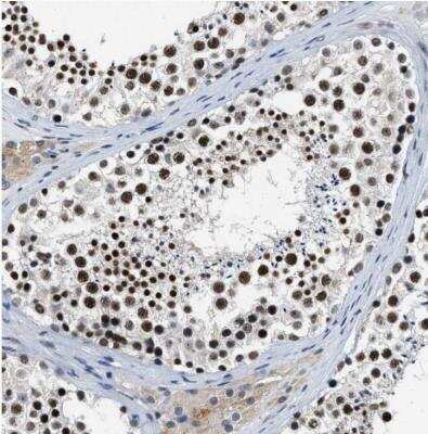 Immunohistochemistry-Paraffin: Cyclin E1 Antibody [NBP1-88153] -  Staining of human testis shows nuclear positivity in cells in seminiferous ducts.