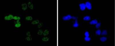 Immunocytochemistry/Immunofluorescence: Cyclin E1 Antibody (SD20-24) [NBP2-67743] - Staining Cyclin E1 in Hela cells (green). The nuclear counter stain is DAPI (blue). Cells were fixed in paraformaldehyde, permeabilised with 0.25% Triton X100/PBS.