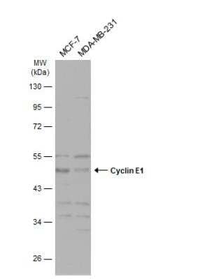 Western Blot: Cyclin E1 Antibody [NBP2-16055] - Various whole cell extracts (30 ug) were separated by 10% SDS-PAGE, and the membrane was blotted with Cyclin E1 antibody diluted at 1:500. The HRP-conjugated anti-rabbit IgG antibody (NBP2-19301) was used to detect the primary antibody, and the signal was developed with Trident ECL plus-Enhanced.