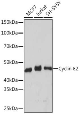 Western Blot: Cyclin E2 Antibody (0Y7G5) [NBP3-16806] - Western blot analysis of extracts of various cell lines, using Cyclin E2 Rabbit mAb (NBP3-16806) at 1:500 dilution. Secondary antibody: HRP Goat Anti-Rabbit IgG (H+L) at 1:10000 dilution. Lysates/proteins: 25ug per lane. Blocking buffer: 3% nonfat dry milk in TBST. Detection: ECL Basic Kit. Exposure time: 3min.