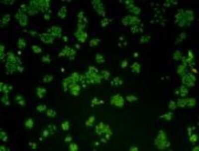Immunocytochemistry/Immunofluorescence: Cyclin E2 Antibody (40-89) [NBP2-67012] - Staining of Hela cells using anti- Cycliin E2 Mouse mAb (Cat. # M0407-15).