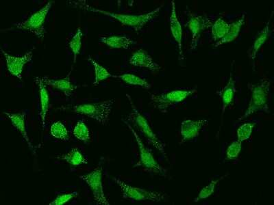 Immunocytochemistry/Immunofluorescence: Cyclin E2 Antibody [NBP2-99464] - Immunofluorescence staining of Cyclin E2 in HeLa cells. Cells were fixed with 4% PFA, permeabilzed with 0.1% Triton X-100 in PBS, blocked with 10% serum, and incubated with rabbit anti-human Cyclin E2 polyclonal antibody (dilution ratio 1:1000) at 4C overnight. Then cells were stained with the Alexa Fluor(R)488-conjugated Goat Anti-rabbit IgG Secondary antibody (green). Positive staining was localized to nucleus and cytoplasm.