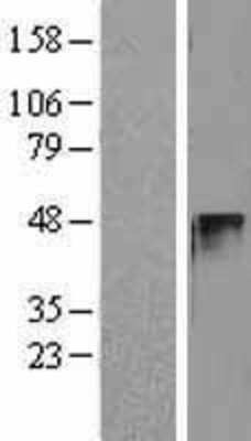 Western Blot: Cyclin E2 Overexpression Lysate (Adult Normal) [NBL1-08878] Left-Empty vector transfected control cell lysate (HEK293 cell lysate); Right -Over-expression Lysate for Cyclin E2.