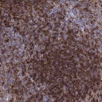 Immunohistochemistry-Paraffin: Cyclin F Antibody [NBP2-57349] - Staining of human tonsil shows high expression.