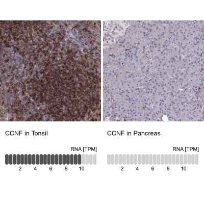 <b>Orthogonal Strategies Validation. </b>Immunohistochemistry-Paraffin: Cyclin F Antibody [NBP2-57349] - Staining in human tonsil and pancreas tissues using anti-CCNF antibody. Corresponding CCNF RNA-seq data are presented for the same tissues.