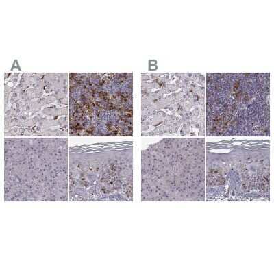 <b>Independent Antibodies Validation. </b>Immunohistochemistry-Paraffin: Cyclin F Antibody [NBP2-57349] - Staining of human liver, lymph node, pancreas and skin using Anti-CCNF antibody NBP2-57349 (A) shows similar protein distribution across tissues to independent antibody NBP2-57569 (B).