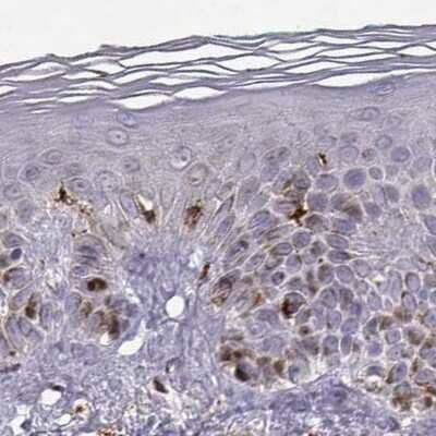 Immunohistochemistry-Paraffin: Cyclin F Antibody [NBP2-57349] - Staining of human skin.