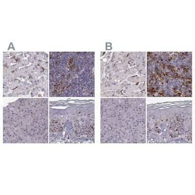 <b>Independent Antibodies Validation. </b>Immunohistochemistry-Paraffin: Cyclin F Antibody [NBP2-57569] - Staining of human liver, lymph node, pancreas and skin using Anti-CCNF antibody NBP2-57569 (A) shows similar protein distribution across tissues to independent antibody NBP2-57349 (B).