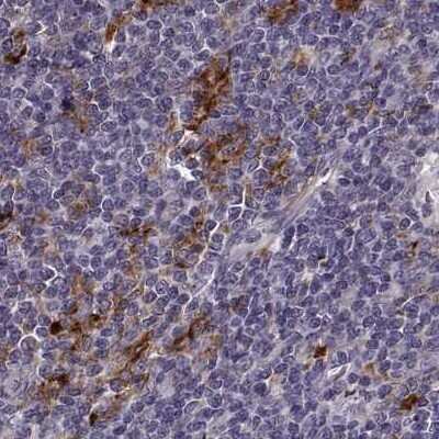 Immunohistochemistry-Paraffin: Cyclin F Antibody [NBP2-57569] - Staining of human lymph node.