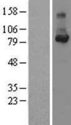 Western Blot: Cyclin F Overexpression Lysate (Adult Normal) [NBL1-08879] Left-Empty vector transfected control cell lysate (HEK293 cell lysate); Right -Over-expression Lysate for Cyclin F.