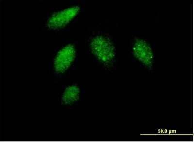 Immunocytochemistry/Immunofluorescence: Cyclin G Antibody [H00000900-B01P] - Analysis of purified antibody to CCNG1 on HeLa cell. (antibody concentration 10 ug/ml)