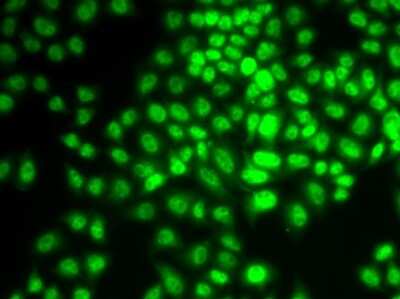 Immunocytochemistry/Immunofluorescence: Cyclin G Antibody [NBP2-92624] - Analysis of HeLa cells using Cyclin G .