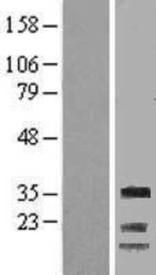 Western Blot: Cyclin G Overexpression Lysate (Adult Normal) [NBL1-08880] Left-Empty vector transfected control cell lysate (HEK293 cell lysate); Right -Over-expression Lysate for Cyclin G.