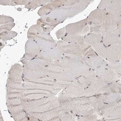 Immunohistochemistry-Paraffin: Cyclin G2 Antibody [NBP1-87518] - Staining of human skeletal muscle shows no positivity in myocytes as expected.