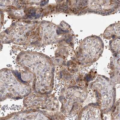 Immunohistochemistry-Paraffin: Cyclin G2 Antibody [NBP1-87518] - Staining of human placenta shows moderate to strong cytoplasmic positivity in trophoblastic cells.