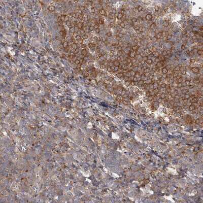 Immunohistochemistry-Paraffin: Cyclin G2 Antibody [NBP1-87518] - Staining of human tonsil shows moderate to strong cytoplasmic positivity in germinal center cells.
