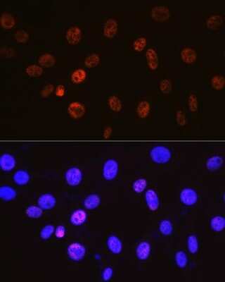 Immunocytochemistry/Immunofluorescence: Cyclin H Antibody (3N5S3) [NBP3-16325] - Immunofluorescence analysis of NIH-3T3 cells using Cyclin H Rabbit mAb (NBP3-16325) at dilution of 1:100 (40x lens). Blue: DAPI for nuclear staining.