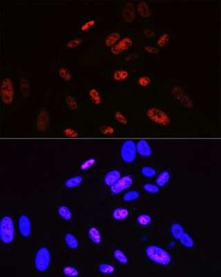 Immunocytochemistry/Immunofluorescence: Cyclin H Antibody (3N5S3) [NBP3-16325] - Immunofluorescence analysis of U-2 OS cells using Cyclin H Rabbit mAb (NBP3-16325) at dilution of 1:100 (40x lens). Blue: DAPI for nuclear staining.