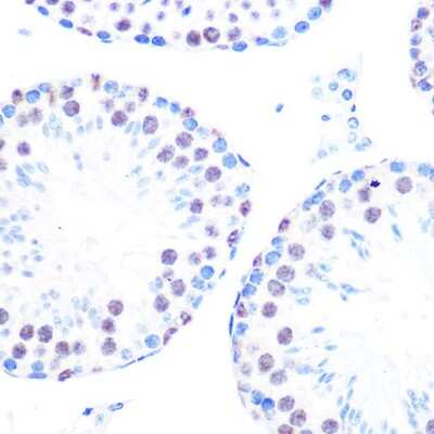 Immunohistochemistry-Paraffin: Cyclin H Antibody (3N5S3) [NBP3-16325] - Immunohistochemistry of paraffin-embedded mouse testis using Cyclin H Rabbit mAb (NBP3-16325) at dilution of 1:100 (40x lens).Perform microwave antigen retrieval with 10 mM PBS buffer pH 7.2 before commencing with IHC staining protocol.