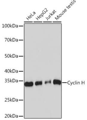 Western Blot: Cyclin H Antibody (3N5S3) [NBP3-16325] - Western blot analysis of extracts of various cell lines, using Cyclin H Rabbit mAb (NBP3-16325) at 1:1000 dilution. Secondary antibody: HRP Goat Anti-Rabbit IgG (H+L) at 1:10000 dilution. Lysates/proteins: 25ug per lane. Blocking buffer: 3% nonfat dry milk in TBST. Detection: ECL Basic Kit. Exposure time: 60s.