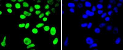 Immunocytochemistry/Immunofluorescence: Cyclin H Antibody (SN20-48) [NBP2-67719] - Staining Cyclin H in MCF-7 cells (green). The nuclear counter stain is DAPI (blue). Cells were fixed in paraformaldehyde, permeabilised with 0.25% Triton X100/PBS.