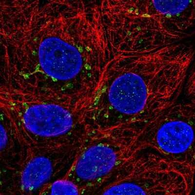 Immunocytochemistry/Immunofluorescence: Cyclin I Antibody [NBP2-56916] - Staining of human cell line MCF7 shows localization to the Golgi apparatus.