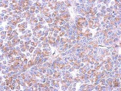 Immunohistochemistry-Paraffin: Cyclin I Antibody [NBP2-47123] - Analysis of paraffin-embedded RF48 xenograft, using antibody at 1:500 dilution.