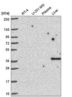 Western Blot: Cyclin I Antibody [NBP2-56916] - Analysis in human cell line RT-4, human cell line U-251 MG, human plasma and human liver tissue.