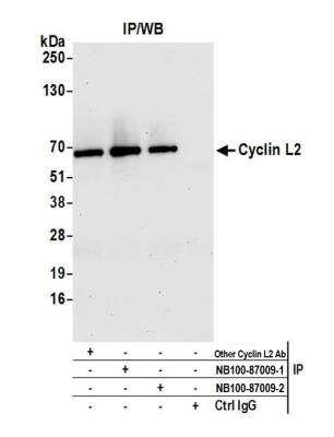 <b>Independent Antibodies Validation. </b>Immunoprecipitation: Cyclin L2 Antibody [NB100-87009] - Detection of human Cyclin L2 by western blot of immunoprecipitates. Samples: Whole cell lysate (1.0 mg per IP reaction; 20% of IP loaded) from Hela cells prepared using NETN lysis buffer. Antibodies: Affinity purified Rabbit anti-Cyclin L2 antibody NB100-87009 (lot 2) used for IP at 6 ug per reaction. Cyclin L2 was also immunoprecipitated by a previous lot of this antibody (lot 1) and rabbit anti-Cyclin L2 antibody from Company B. For blotting immunoprecipitated Cyclin L2, NB100-87009 was used at 0.04 ug/ml. Detection: Chemiluminescence with an exposure time of 10 seconds.