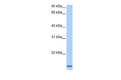 Western Blot: Cyclin L2 Antibody [NBP2-84745] - WB Suggested Anti-CCNL2 Antibody Titration: 0.2-1 ug/ml. Positive Control: Jurkat cell lysateCCNL2 is supported by BioGPS gene expression data to be expressed in Jurkat