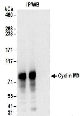 Immunoprecipitation: Cyclin M3 Antibody [NBP2-32133] - Samples:  Whole cell lysate (1 mg for IP; 20% of IP loaded) from 293T cells.  Antibodies:  Affinity purified rabbit anti-Cyclin M3 antibody NBP2-32133 used for IP at 6 ug/mg lysate. For blotting immunoprecipitated Cyclin M3 was used at 1 ug/ml.  Detection: Chemiluminescence with an exposure time of 3 seconds.