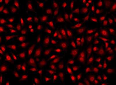 Immunocytochemistry/Immunofluorescence: Cyclin-O Antibody [NBP3-05932] - Staining of CCNO in Hela cells. Cells were fixed with 4% PFA, permeabilzed with 0.1% Triton X-100 in PBS,blocked with 10% serum, and incubated with rabbit anti-Human CCNO polyclonal antibody (dilution ratio 1:200) at 4? overnight. Then cells were stained with the Alexa Fluor®594-conjugated Goat Anti-rabbit IgG secondary antibody (red). Positive staining was localized to Nucleus.