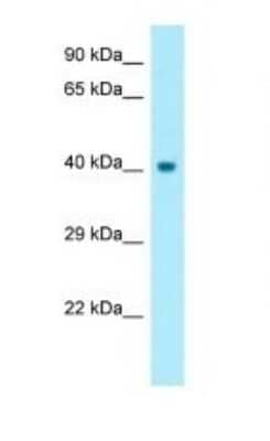 Western Blot: Cyclin-O Antibody [NBP1-98285] - Titration: 1.0 ug/ml Positive Control: Fetal Heart.