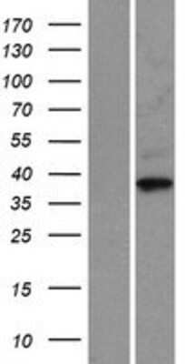 Western Blot: Cyclin-O Overexpression Lysate (Adult Normal) [NBP2-06557] Left-Empty vector transfected control cell lysate (HEK293 cell lysate); Right -Over-expression Lysate for Cyclin-O.