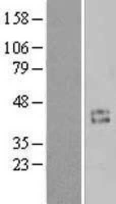 Western Blot Cyclin I Overexpression Lysate