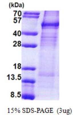 SDS-Page: Cyclin Protein [NBP2-22970]