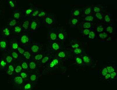 Immunocytochemistry/Immunofluorescence: Cyclin T1 Antibody [NBP3-06557] - Staining of CCNT1 in A431 cells. Cells were fixed with 4% PFA, permeabilzed with 0.3% Triton X-100 in PBS,blocked with 10% serum, and incubated with rabbit anti-Human CCNT1 polyclonal antibody (dilution ratio 1:200) at 4? overnight. Then cells were stained with the Alexa Fluor®488-conjugated Goat Anti-rabbit IgG secondary antibody (green). Positive staining was localized to Nucleus.