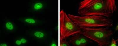 Immunocytochemistry/Immunofluorescence: Cyclin T1 Antibody [NBP3-13224] - Cyclin T1 antibody detects Cyclin T1 protein at nucleus by immunofluorescent analysis. Sample: HeLa cells were fixed in 4% paraformaldehyde at RT for 15 min. Green: Cyclin T1 protein stained by Cyclin T1 antibody (NBP3-13224) diluted at 1:500. Red: Phalloidin, a cytoskeleton marker, diluted at 1:100.