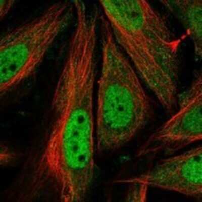 Immunocytochemistry/Immunofluorescence: Cyclin T1 Antibody [NBP3-17238] - Staining of human cell line SiHa shows localization to nucleoplasm.