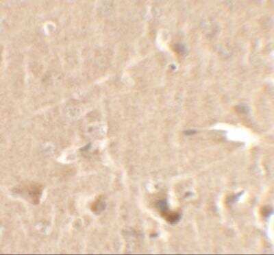 Immunohistochemistry: Cyclin T1 Antibody [NBP2-81898] - Analysis of Cyclin T1 in rat brain tissue with Cyclin T1 antibody at 2.5 ug/ml.