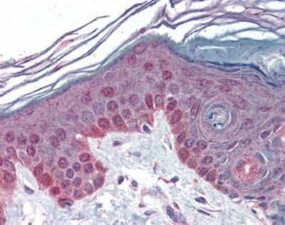 Immunohistochemistry-Paraffin: Cyclin T1 Antibody [NBP1-02800] - Staining of human skin. Immunohistochemistry of formalin-fixed, paraffin-embedded tissue after heat-induced antigen retrieval. Antibody dilution 1:500.