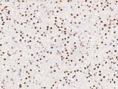 Immunohistochemistry-Paraffin: Cyclin T1 Antibody [NBP3-06557] - Staining of human CCNT1 in human adrenal gland with rabbit polyclonal antibody at 1:500 dilution.