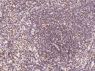 Immunohistochemistry-Paraffin: Cyclin T1 Antibody [NBP3-06557] - Staining of human CCNT1 in human lymph node with rabbit polyclonal antibody at 1:500 dilution.