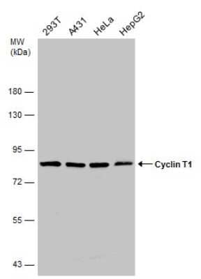 Western Blot: Cyclin T1 Antibody [NBP3-13224] - Various whole cell extracts (50 ug) were separated by 7.5% SDS-PAGE, and the membrane was blotted with Cyclin T1 antibody (NBP3-13224) diluted at 1:1000.