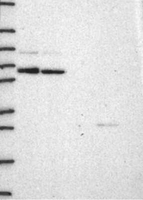 Western Blot: Cyclin T1 Antibody [NBP3-17238] - Lane 1: Marker [kDa] 250, 130, 95, 72, 55, 36, 28, 17, 10;   Lane 2: RT4;   Lane 3: U-251 MG;   Lane 4: Human Plasma;   Lane 5: Liver;   Lane 6: Tonsil