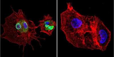 Immunocytochemistry/Immunofluorescence: Cyclophilin 40 Antibody [NB120-3562] - Analysis of Cyclophilin D in HepG2 Cells. Cells were grown on chamber slides and fixed with formaldehyde prior to staining. Cells were probed without (control) or with a Cyclophilin D polyclonal antibody at a dilution of 1:200 overnight at 4C, washed with PBS and incubated with a DyLight-488 conjugated secondary antibody. Cyclophilin D staining (green), F-Actin staining with Phalloidin (red) and nuclei with DAPI (blue) is shown.